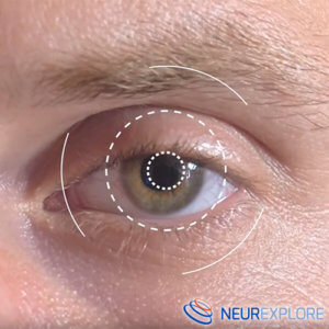 Neurexplore comunicato